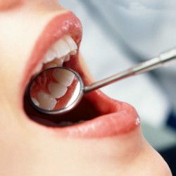 осмотр зубов перед лечением